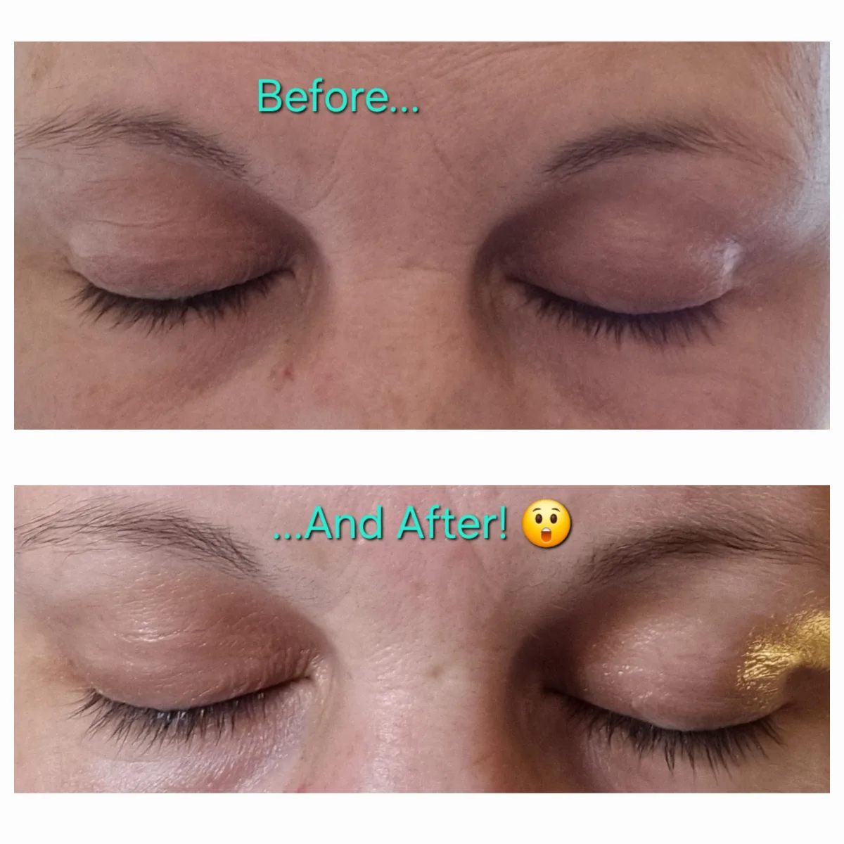 Multi-Peptide Lash and Brow Serum - review image