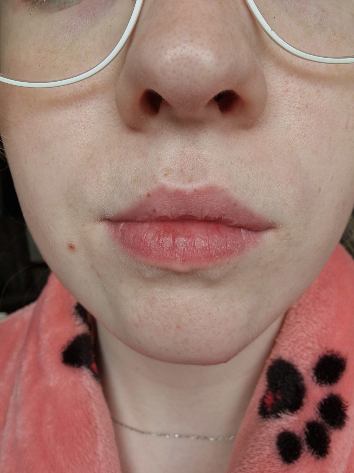 Benefit Splashtint - before review image