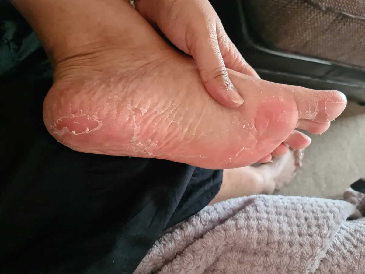 Exfoliating Watermelon & Citrus Foot Peel - review image