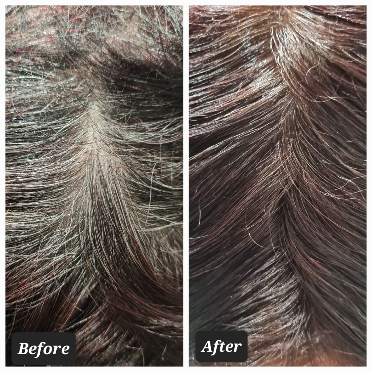 L'OREAL MAGIC RETOUCH DUNKELBLOND BIS HELLBRAUN SOFORT ANSTATZ-KASCHIERSPRAY - review image