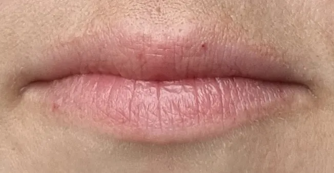 Tripeptide Plumping Lip Balm - before review image