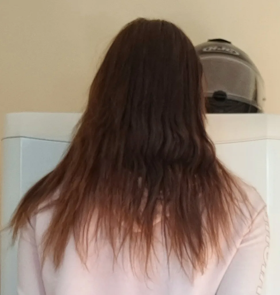 Biotin - before review image