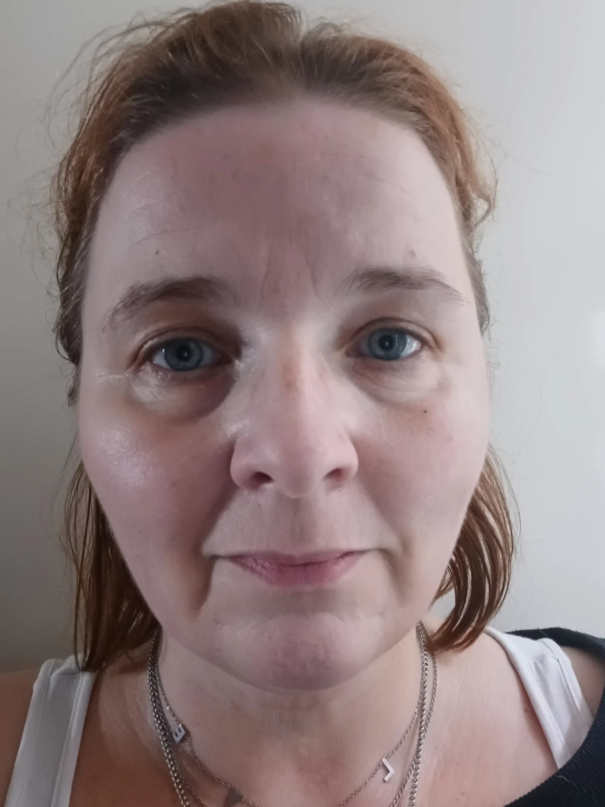 Lift HD+ Lifting Firming Face And Neck Cream - before review image