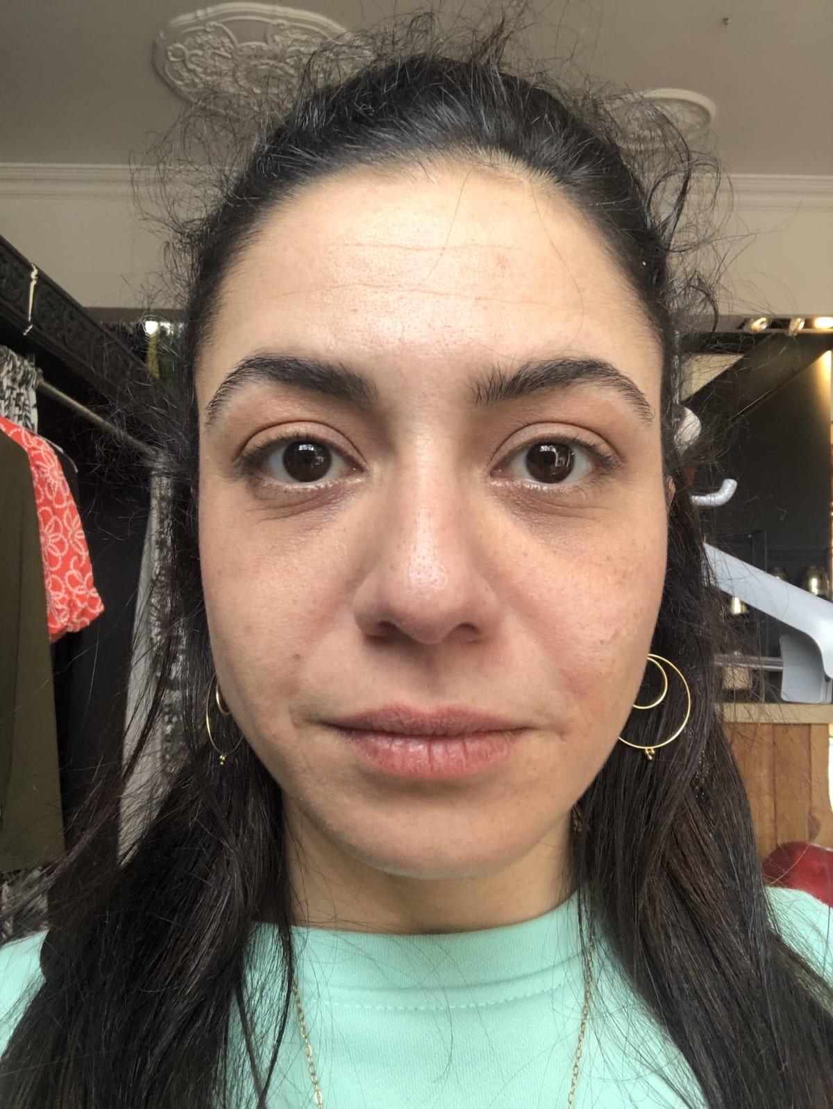 The Ordinary Niacinamide 10% + Zinc 1% - review image