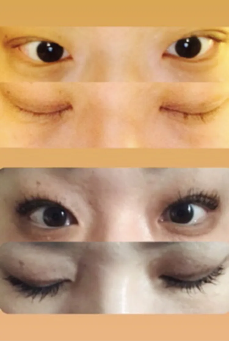 RapidLash Eyelash Enhancing Serum - review image