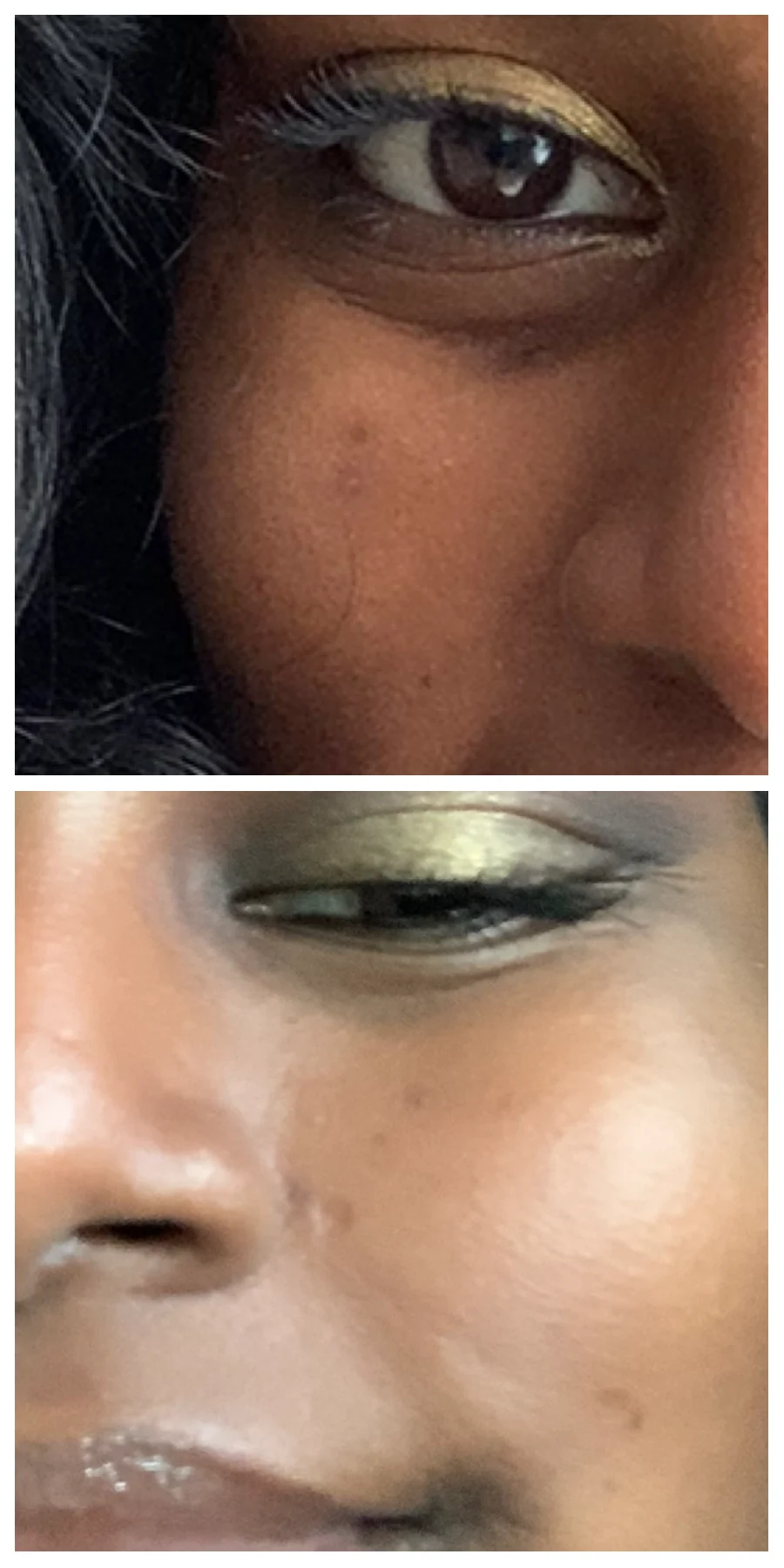 Clinique Even Better Clinical Radical Dark Spot Corrector + Interrupter - review image