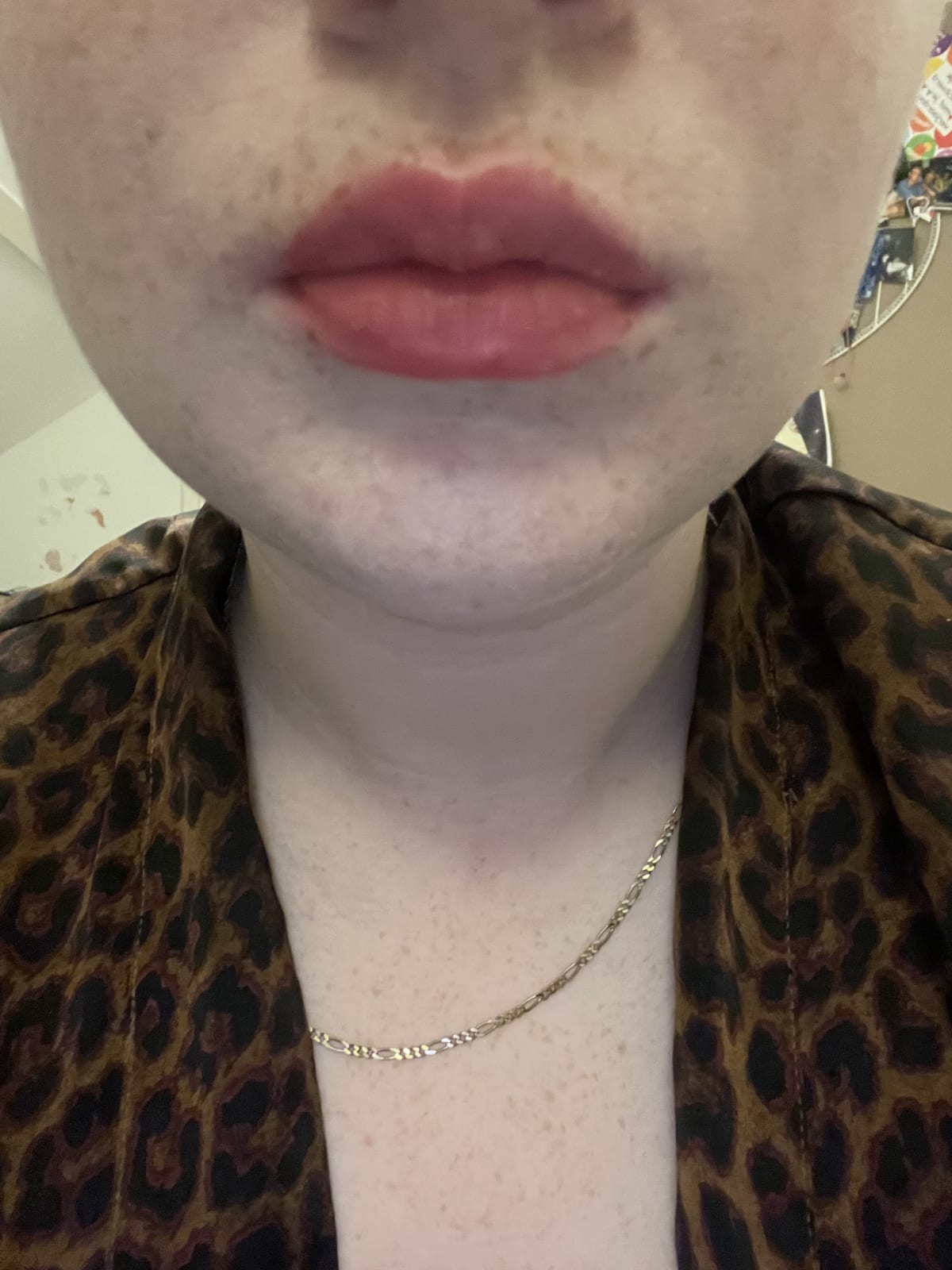 POUTSICLE HYDRATING LIP STAIN - Mai Type - review image