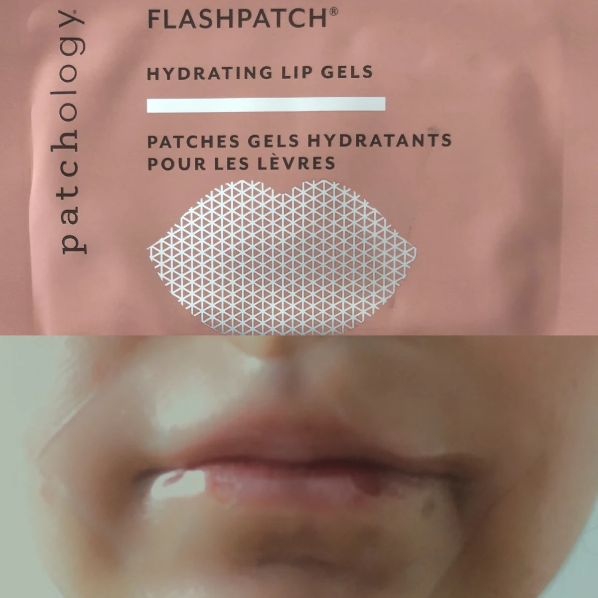 Patchology FlashPatch Hydrating Lip Gel - review image