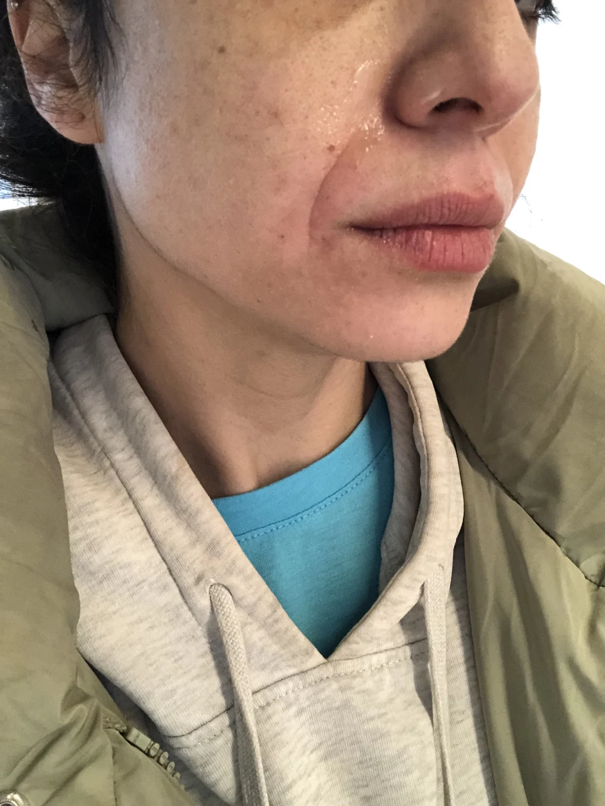 The Ordinary Niacinamide 10% + Zinc 1% - before review image