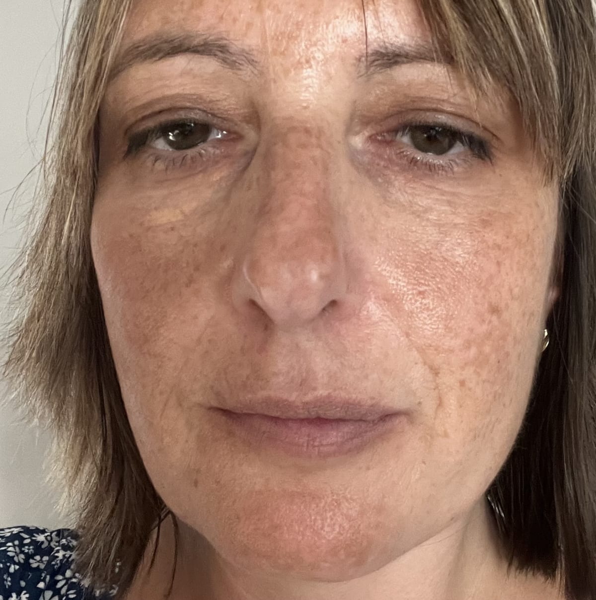 Anti-Age Retinol Boost Day Cream SPF 15 - before review image