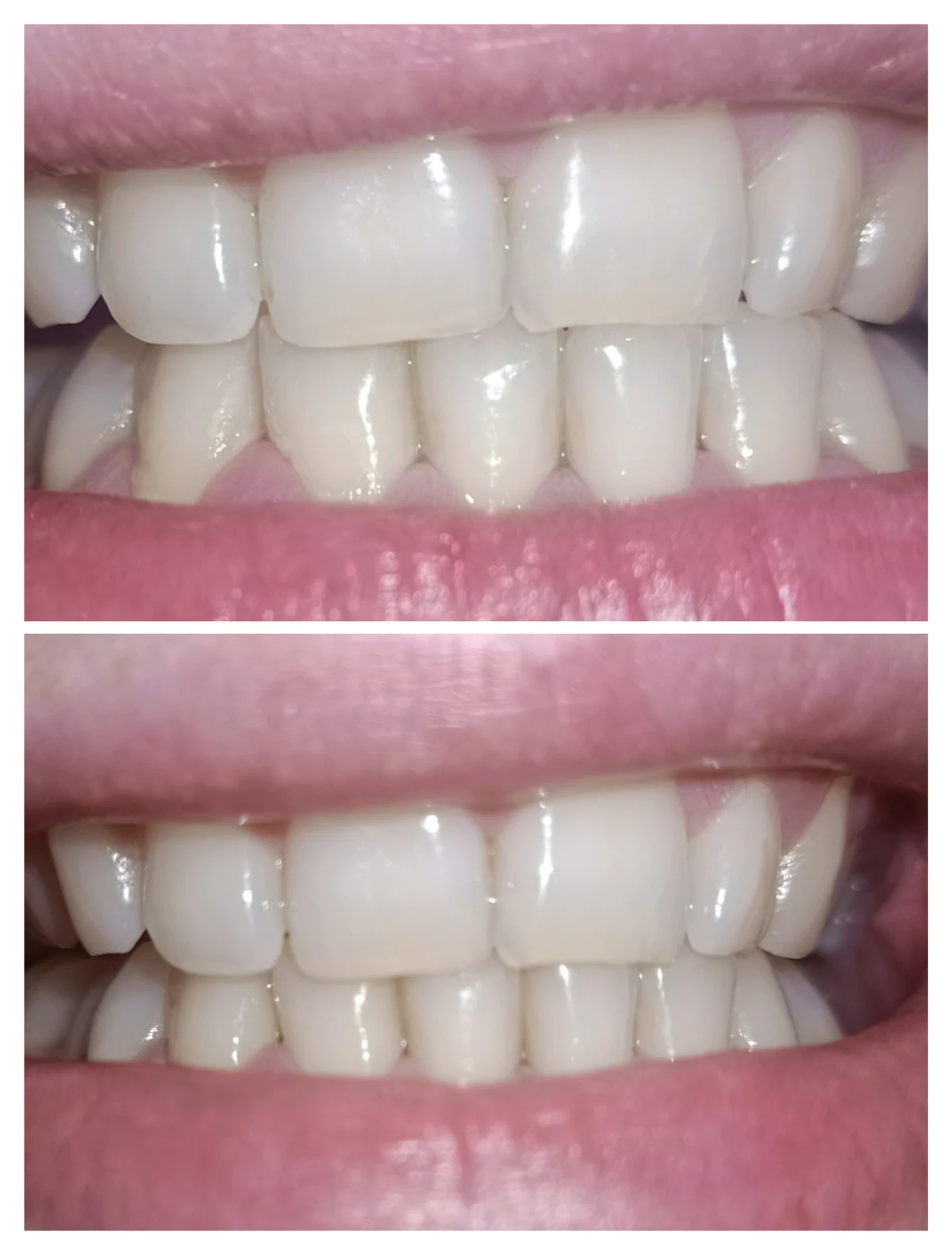 Professional Choice Whitening Toothpaste - review image