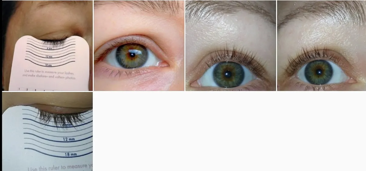 xLash Eyelash Serum - review image