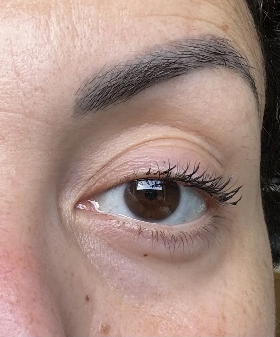 MIRACLE PURE EYE ENHANCER - before review image