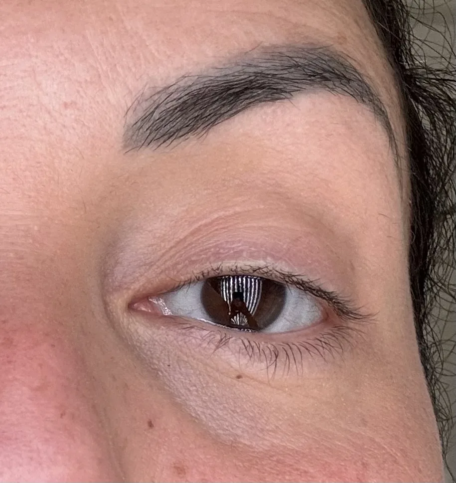 MIRACLE PURE EYE ENHANCER - review image