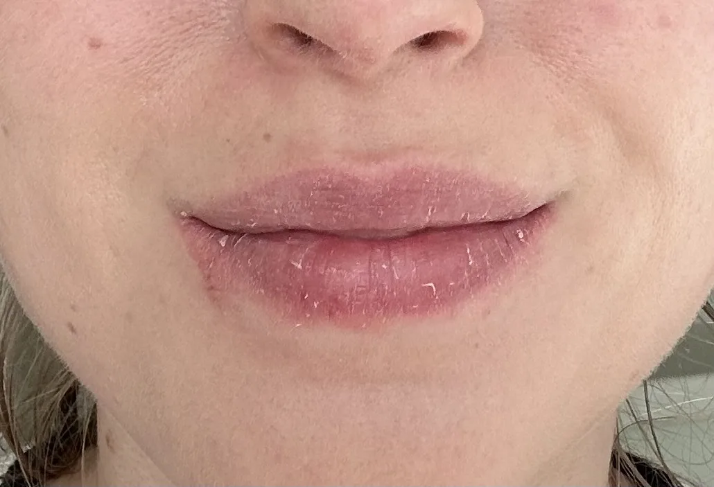 Lip & Body Balsem - before review image