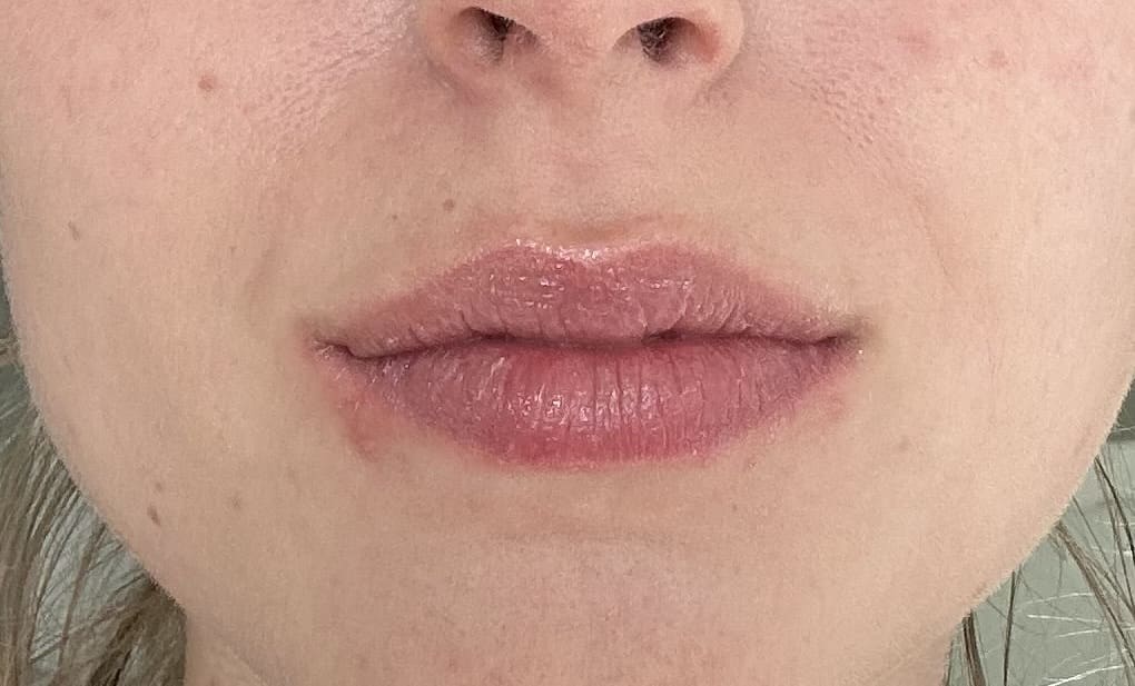 Lip & Body Balsem - review image