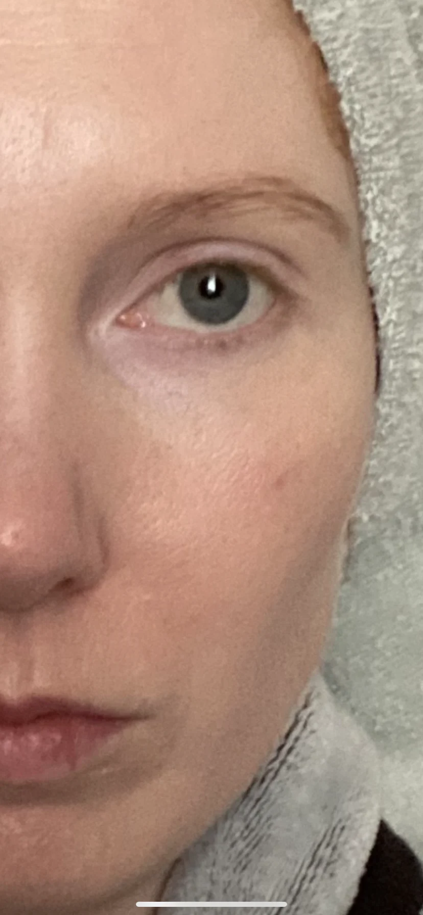 Silymarin CF - before review image