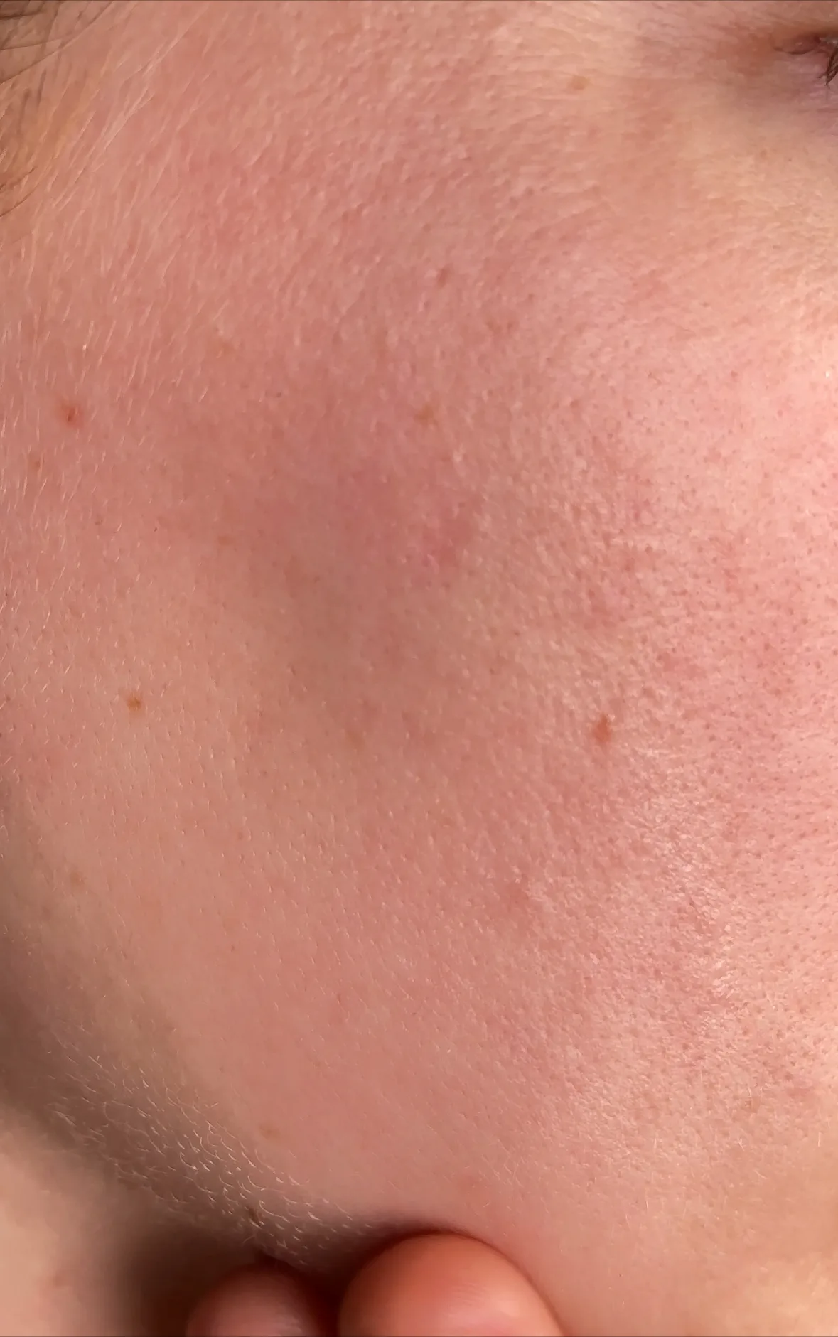 Moisturising Gel Cream - before review image