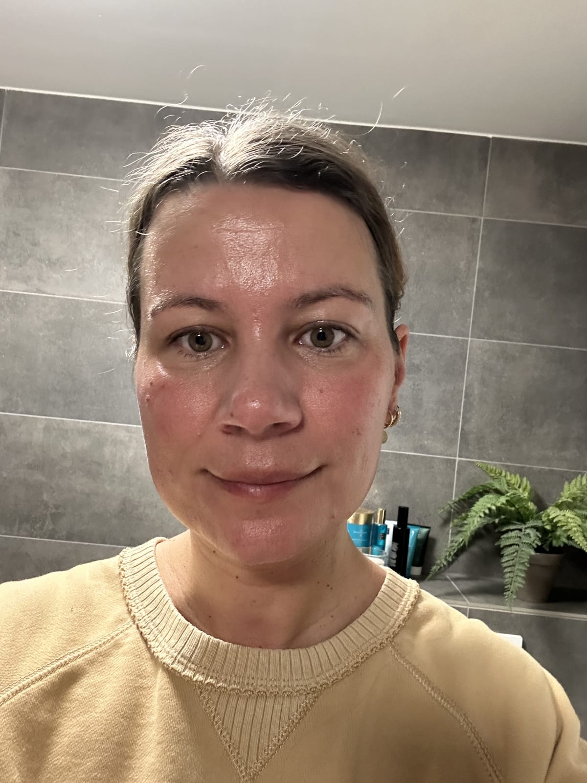 3 In 1 Anti-Redness Miracle Formula - before review image