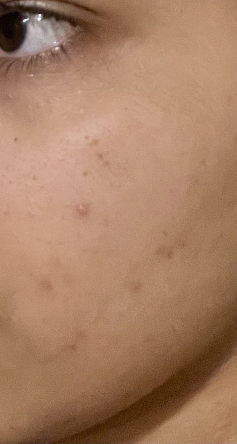 Facial Moisturising Lotion - before review image