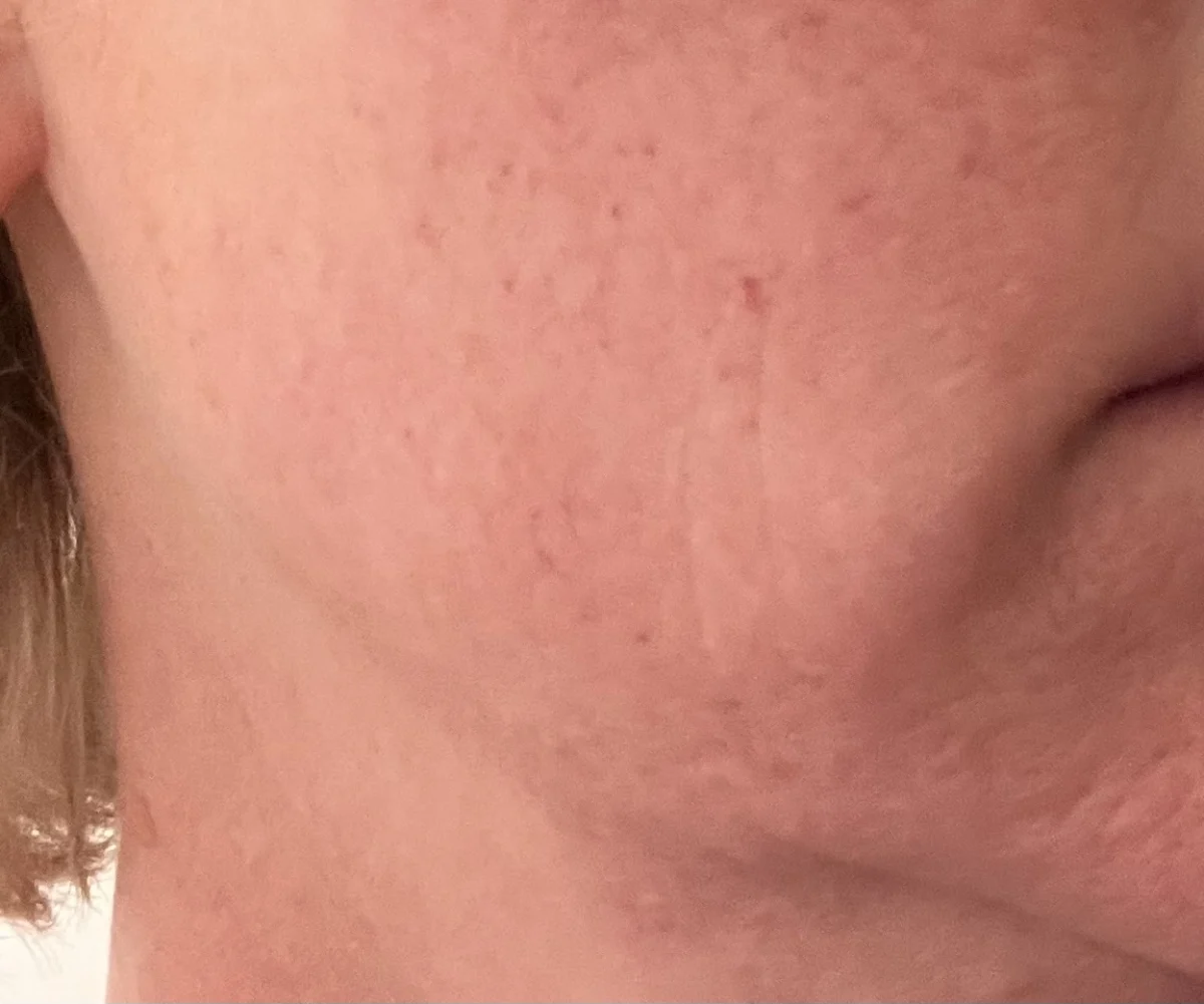 Uplifting and Firming Advanced Cream - before review image