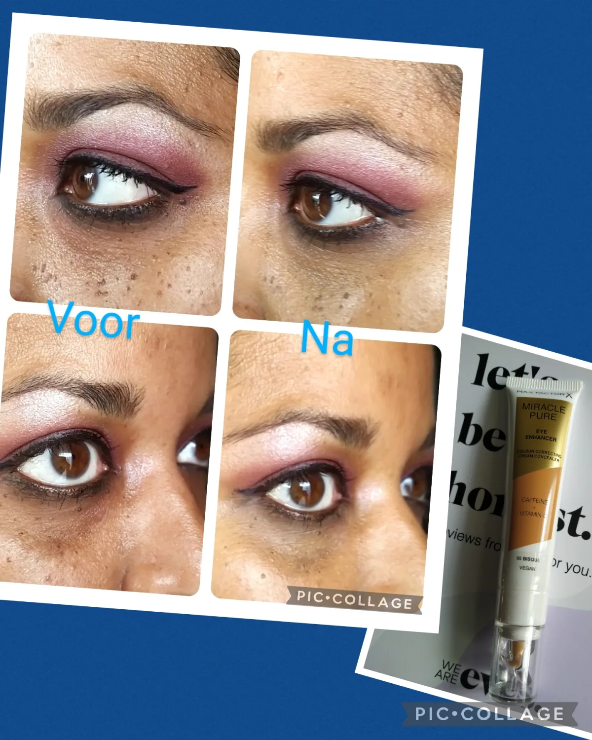 MIRACLE PURE EYE ENHANCER - review image