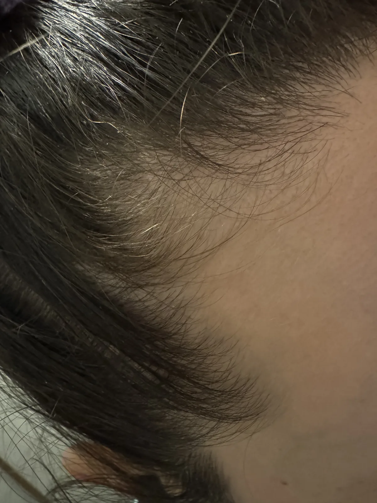 ELVIVE FIBER BOOSTER SERUM - before review image