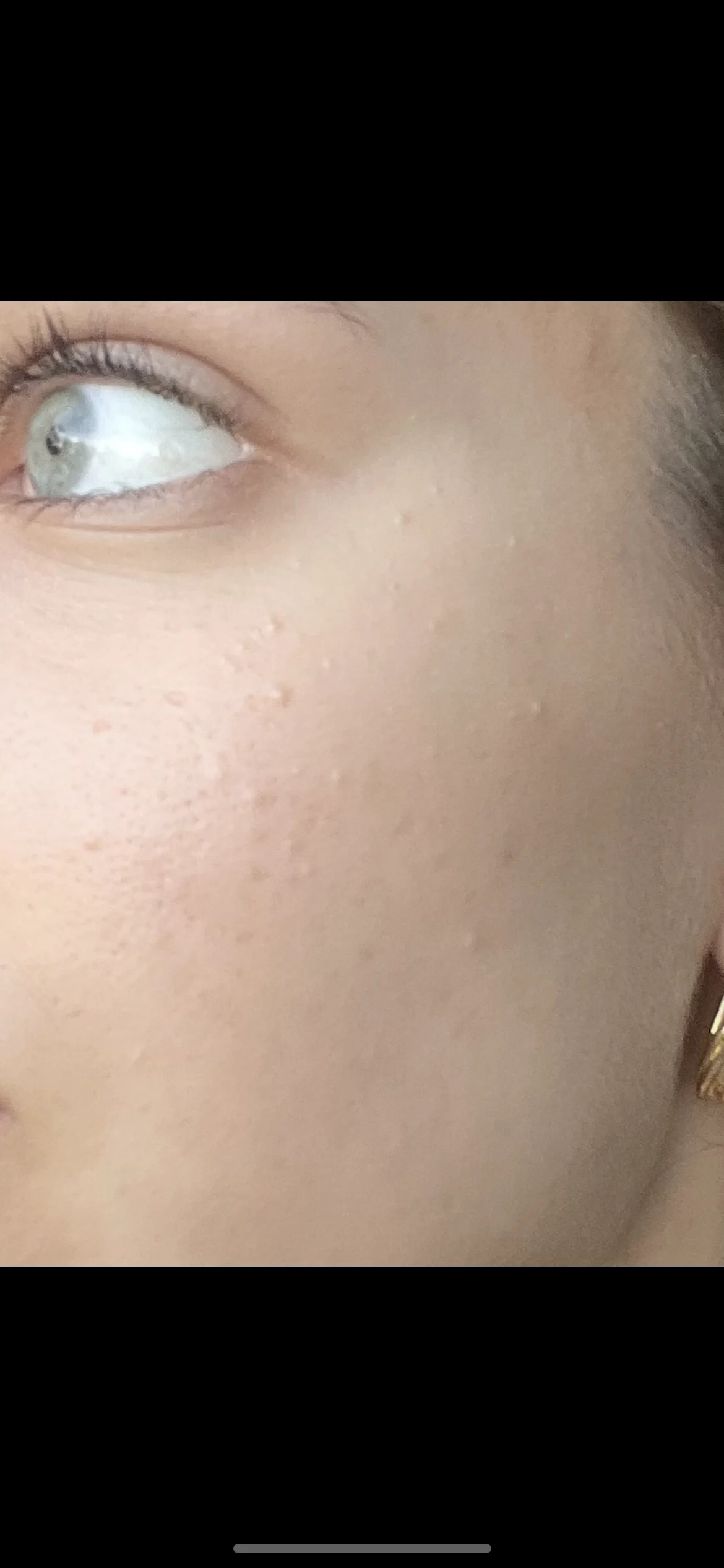 CeraVe Blemish Control Face Cleanser with 2% Salicylic Acid & Niacinamide for Blemish-Prone Skin 236ml - review image