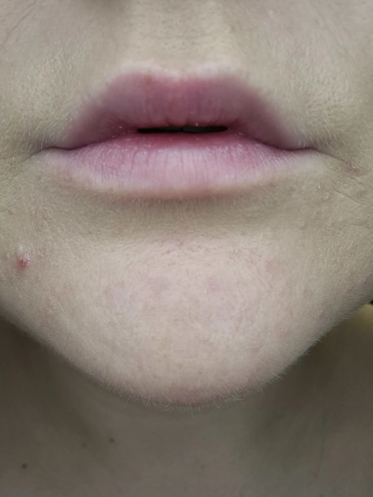 2000 CALORIE LIP GLAZE - before review image