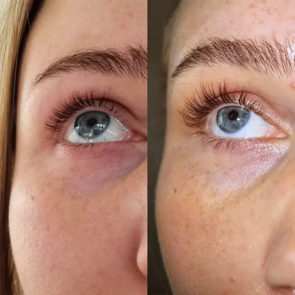 Sweed Eyelash Growth Serum - review image