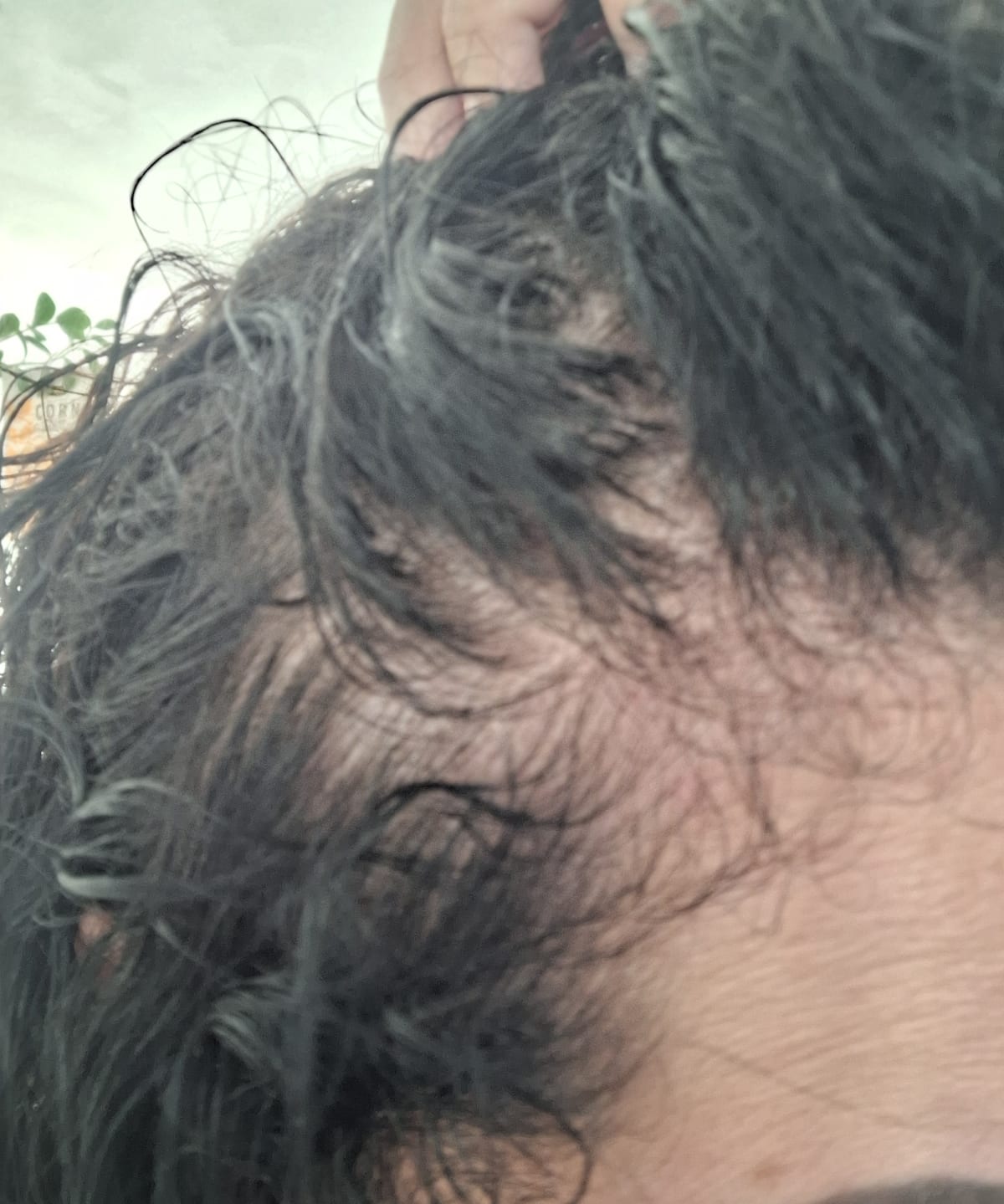 ELVIVE FIBER BOOSTER SERUM - before review image