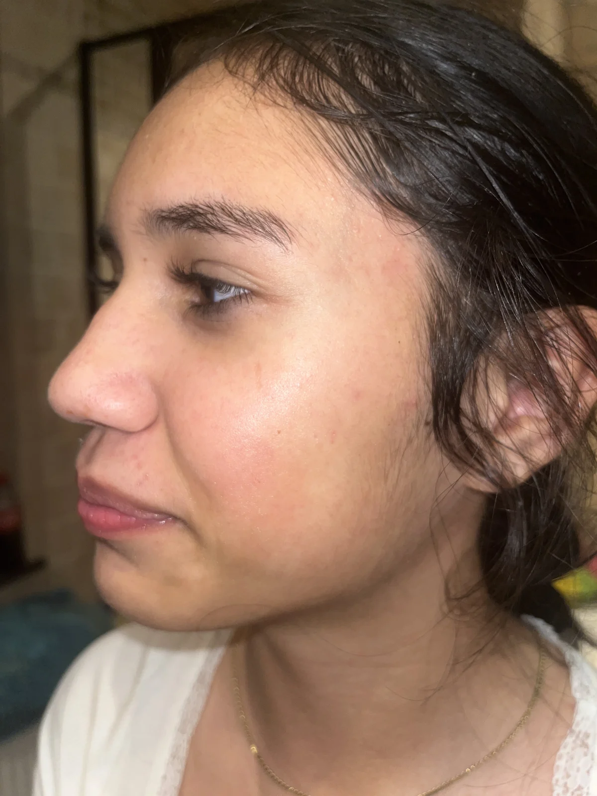 The Ordinary Niacinamide 10% + Zinc 1% - review image