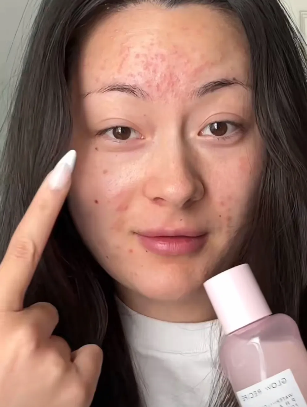 Watermelon Glow PHA + BHA Pore-Tight Toner - before review image