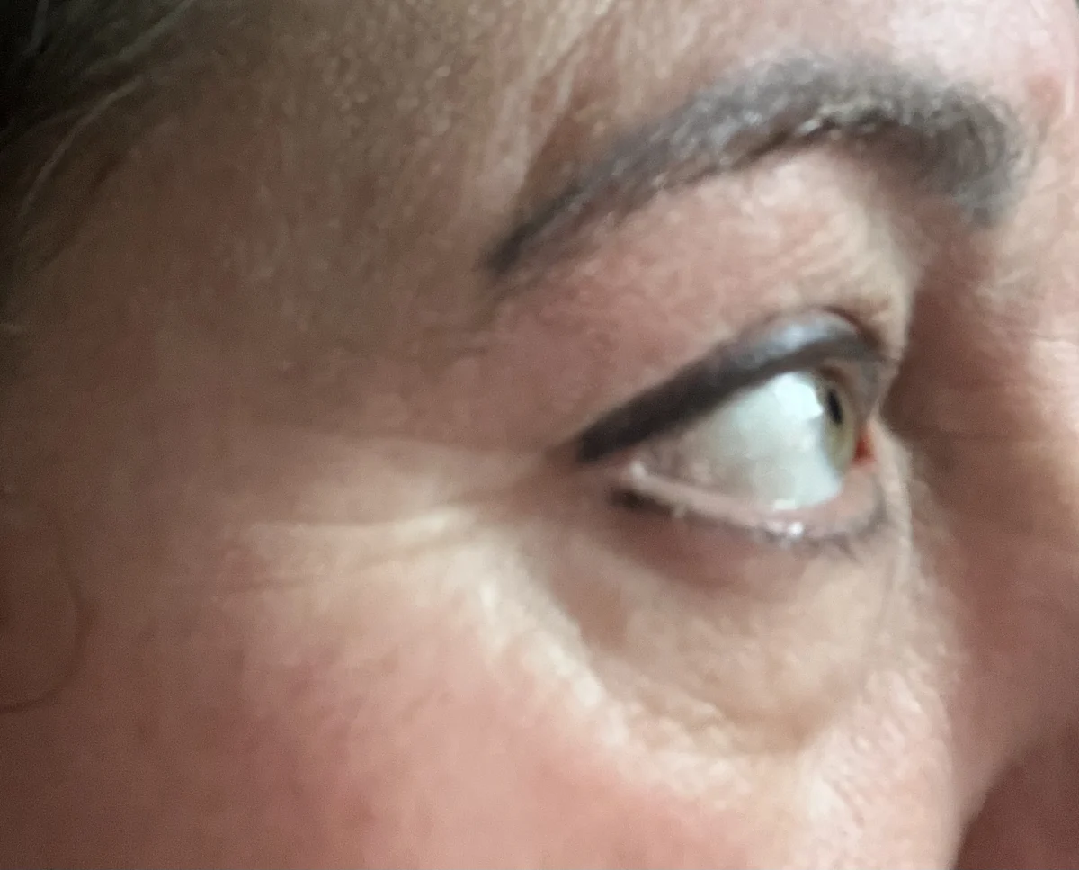 Wrinkle Smoothing Eye Cream - before review image