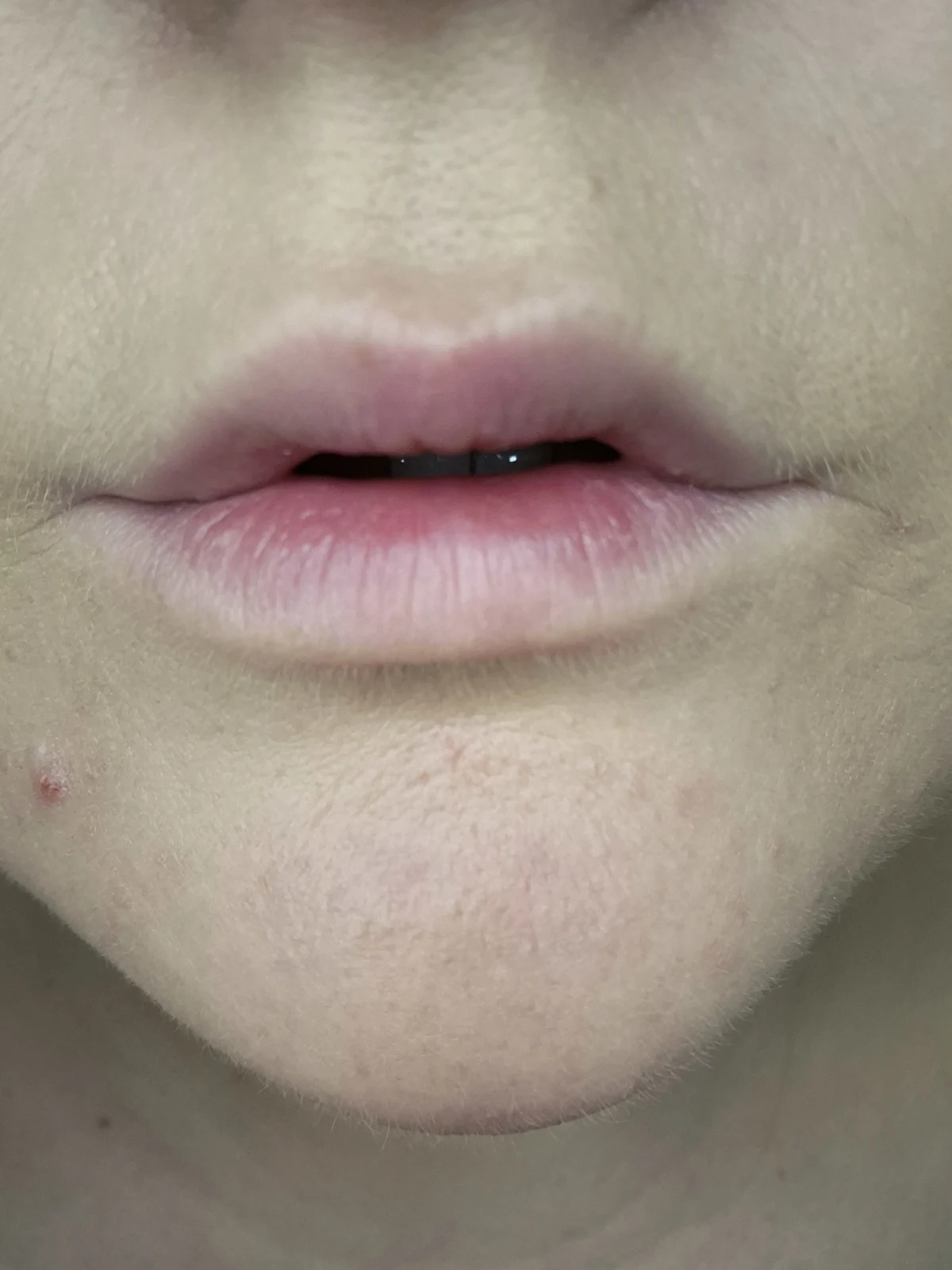 2000 CALORIE LIP GLAZE - before review image
