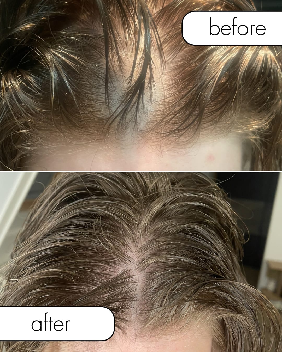 ELVIVE FIBER BOOSTER SHAMPOO - review image