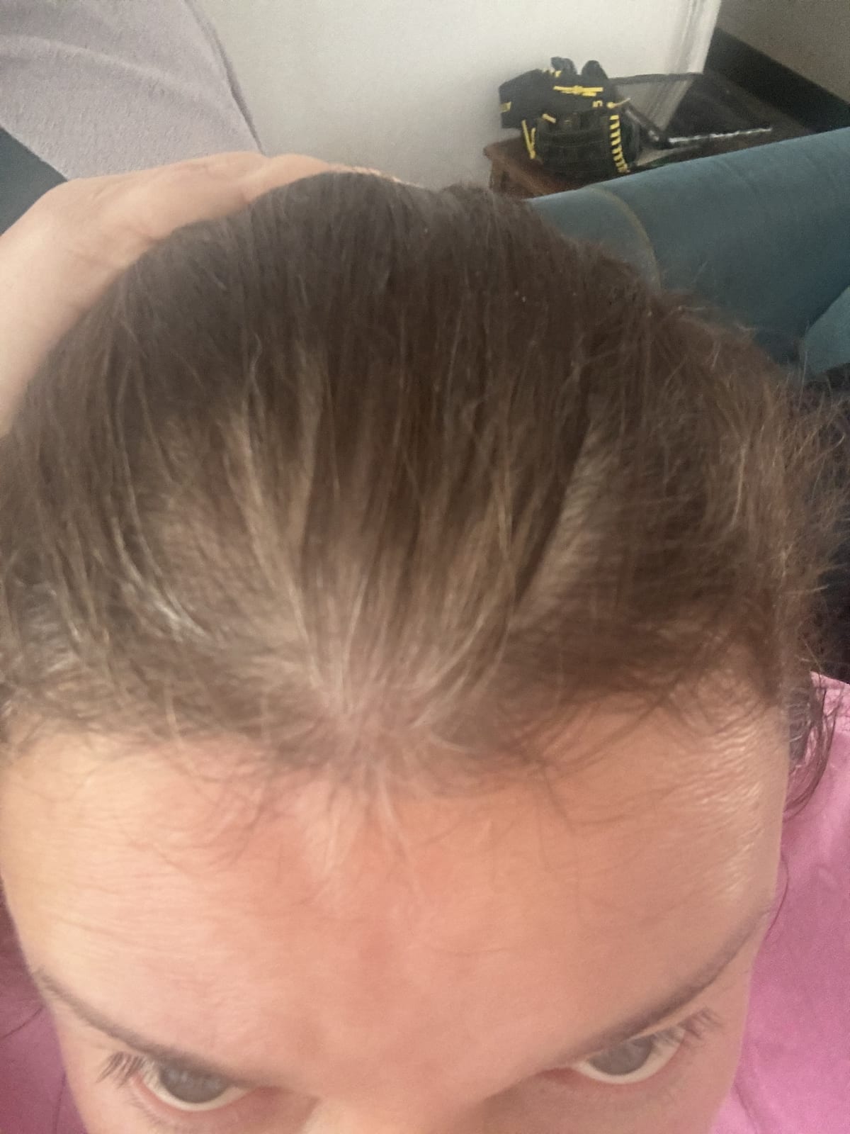 ELVIVE FIBER BOOSTER SERUM - before review image