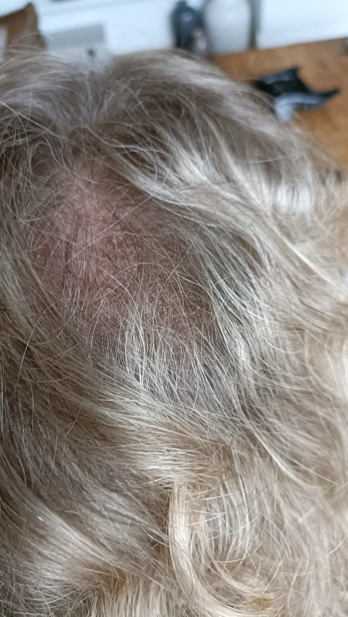 ELVIVE FIBER BOOSTER SERUM - before review image