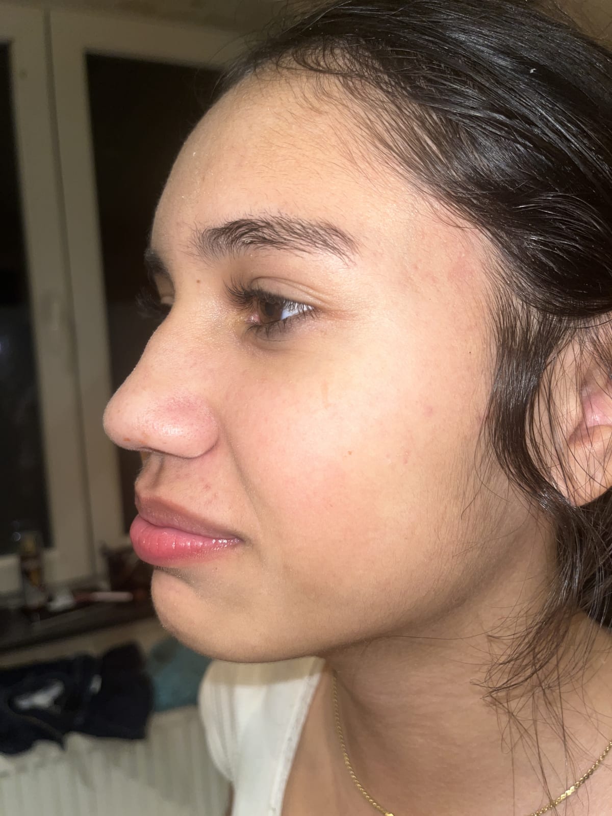 The Ordinary Niacinamide 10% + Zinc 1% - before review image