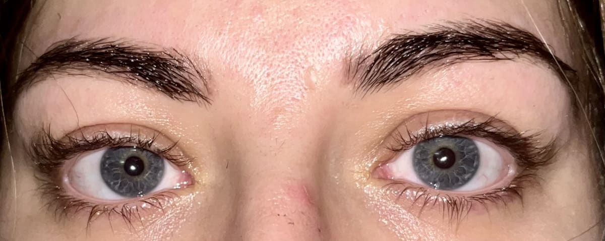 Lash Serum - before review image