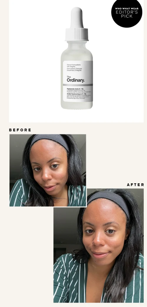Hyaluronic Acid (HA) 2% + B5 - hydraterend serum - review image