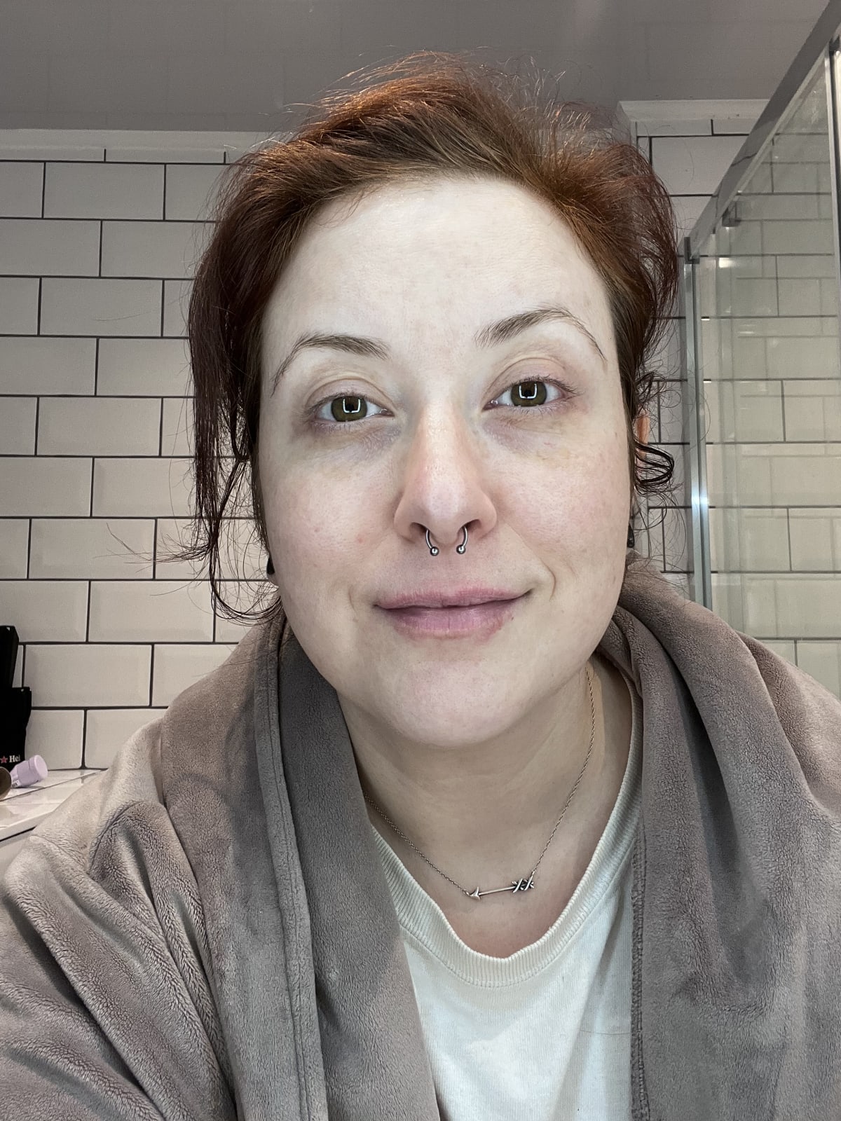 NIGHT RENEWAL SERUM - before review image