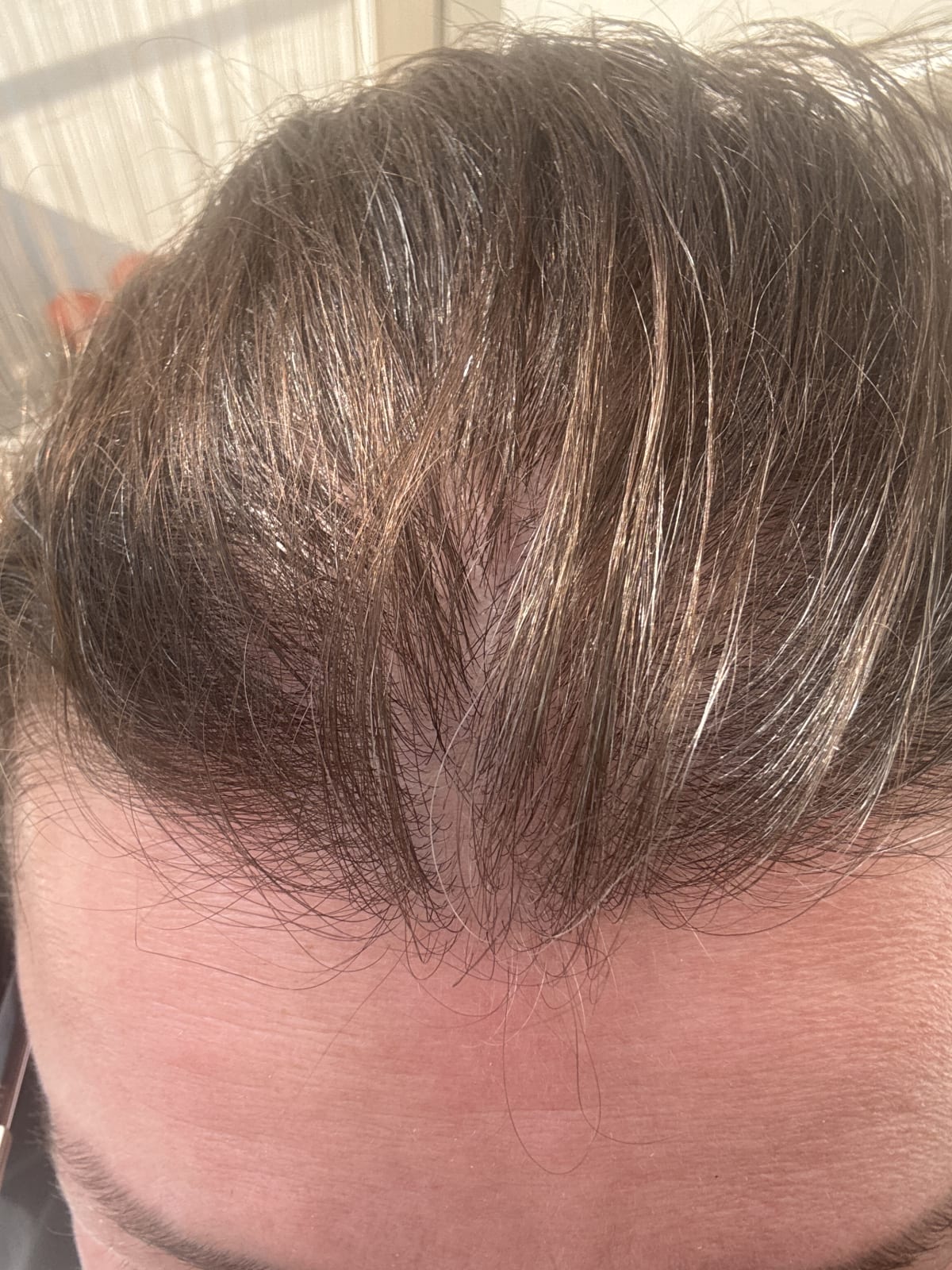 ELVIVE FIBER BOOSTER SERUM - review image