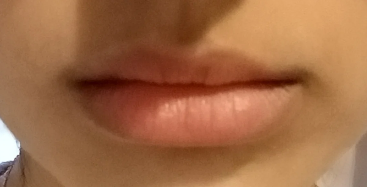 Lip Repair Lipbalm - review image