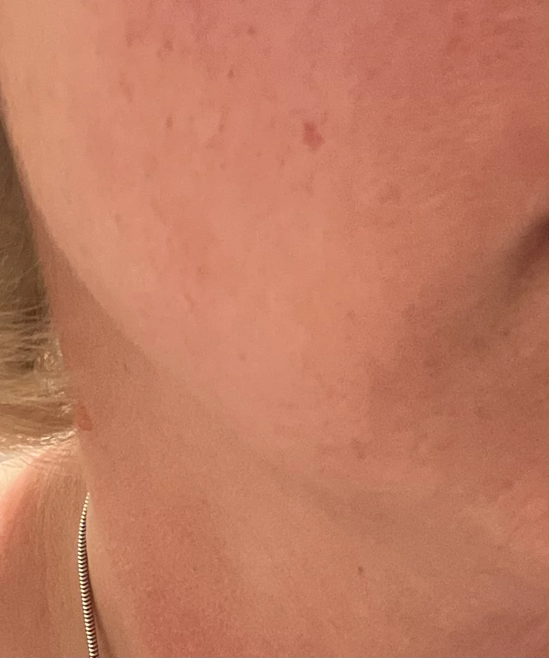 Uplifting and Firming Advanced Cream - review image