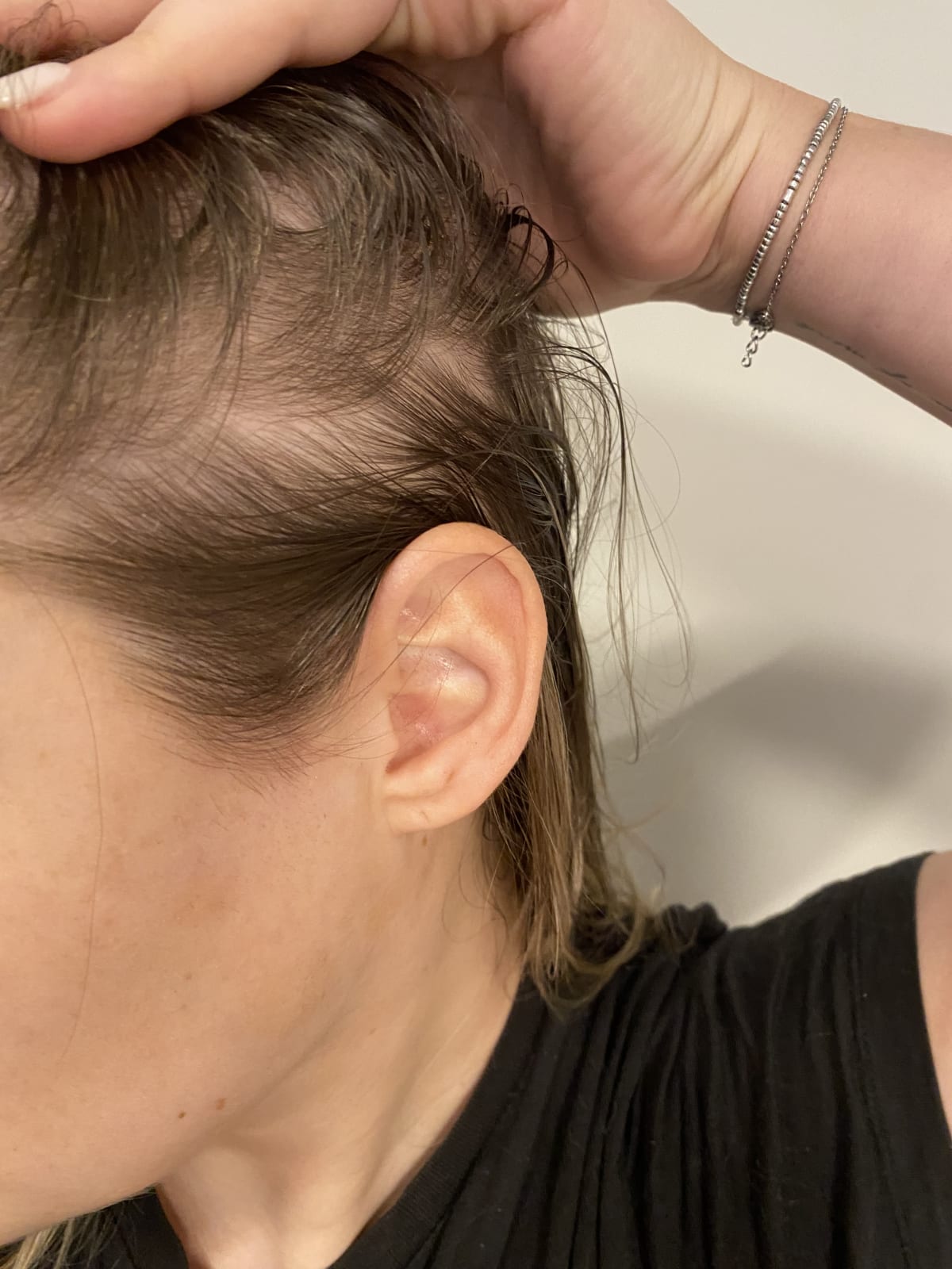 ELVIVE FIBER BOOSTER SERUM - before review image
