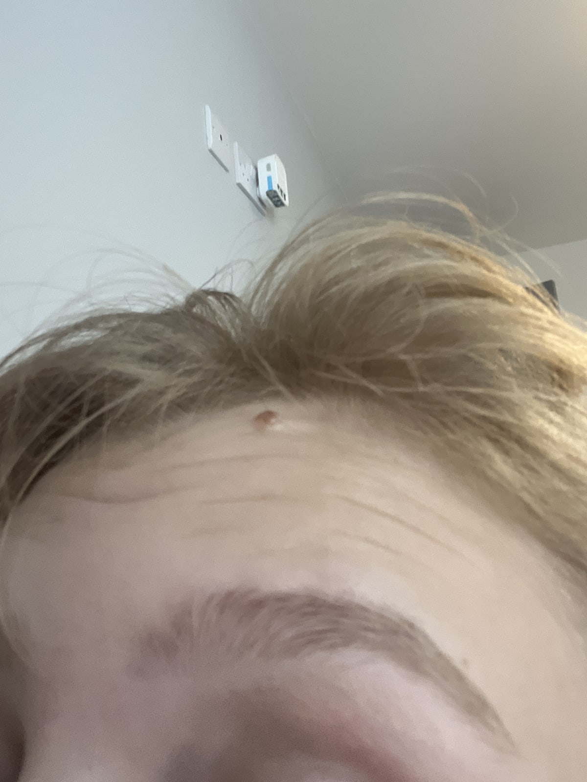 Brow Lift Clear - before review image