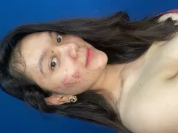 user avatar acne._positivity